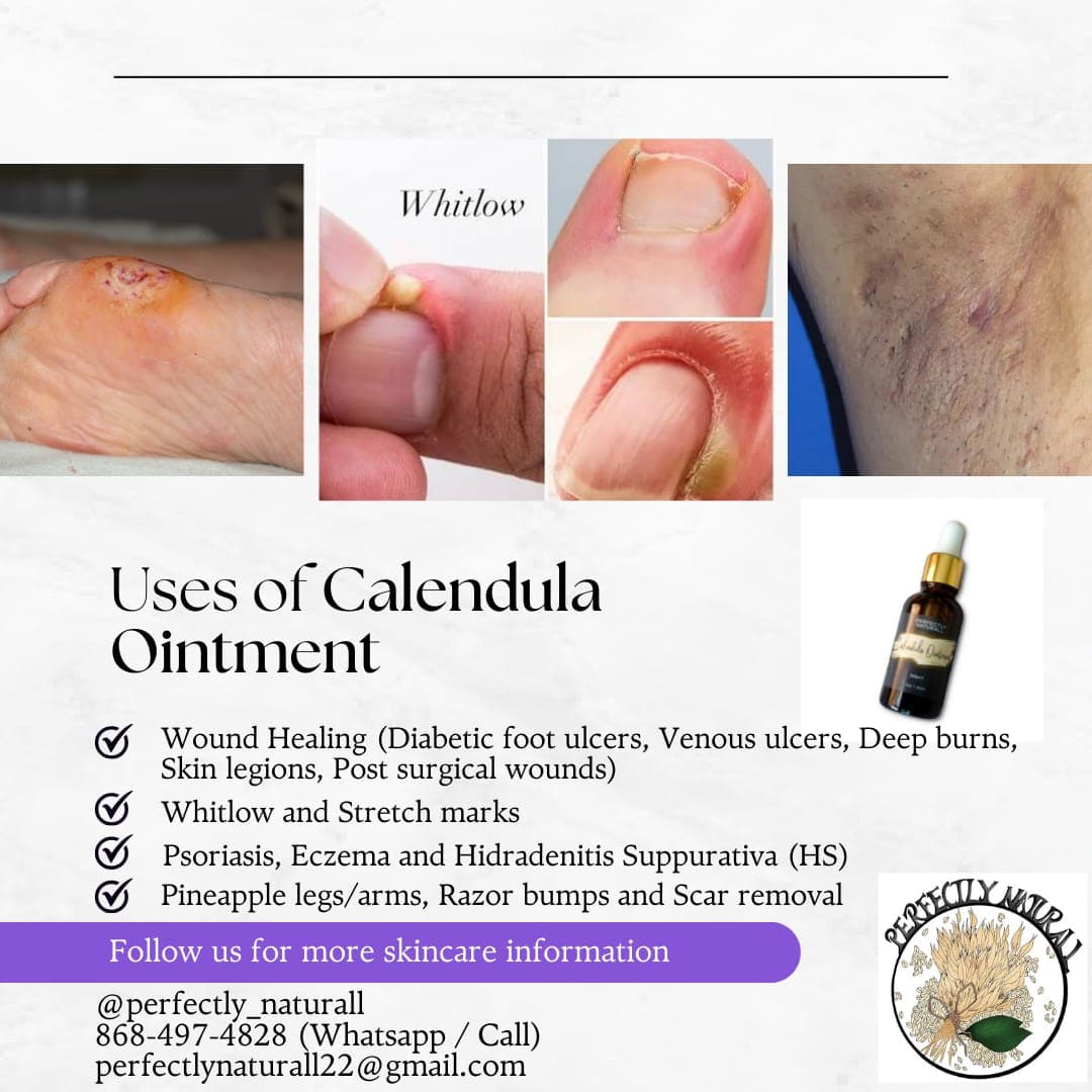 Calendula Ointment